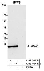 VMA21 Antibody in Western Blot (WB)