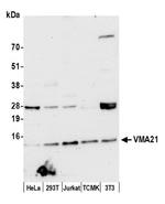 VMA21 Antibody in Western Blot (WB)