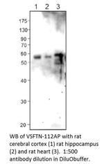 Visfatin Antibody in Western Blot (WB)