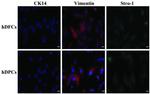 Vimentin Antibody in Immunocytochemistry (ICC/IF)