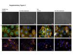 Vinculin Antibody in Immunocytochemistry (ICC/IF)