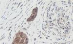 WNT1 Antibody in Immunohistochemistry (Paraffin) (IHC (P))