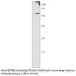 ZFP36L2 Antibody in Western Blot (WB)