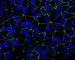 ZO-1 Antibody in Immunocytochemistry (ICC/IF)