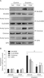 Acetylated Lysine Antibody in Western Blot (WB)