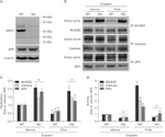 Acetylated Lysine Antibody in Western Blot (WB)