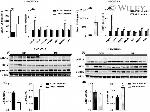 Phospho-IRE1 alpha (Ser724) Antibody in Western Blot (WB)