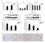 CHI3L1 Antibody in Immunohistochemistry (IHC)