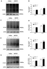 alpha Synuclein Antibody in Western Blot (WB)