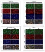 alpha Tubulin Antibody in Immunocytochemistry (ICC/IF)