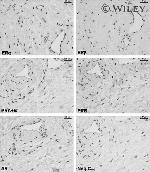 Progesterone Receptor Antibody in Immunohistochemistry (IHC)