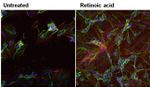 beta-3 Tubulin Antibody in Immunocytochemistry (ICC/IF)