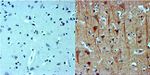 beta-3 Tubulin Antibody in Immunohistochemistry (Paraffin) (IHC (P))