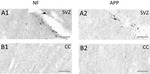 beta Amyloid Antibody in Immunohistochemistry (IHC)