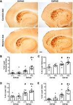 beta Amyloid Antibody in Immunohistochemistry (IHC)