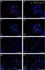 FOXP3 Antibody in Immunohistochemistry (IHC)