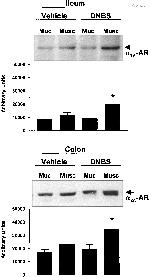 alpha-2a Adrenergic Receptor Antibody in Western Blot (WB)