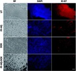 Ki-67 Antibody in Immunohistochemistry (IHC)