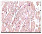 Cardiac Troponin I Antibody in Immunohistochemistry (Paraffin) (IHC (P))