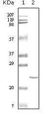 Cardiac Troponin I Antibody in Western Blot (WB)