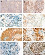 HMGB1 Antibody in Immunohistochemistry (IHC)