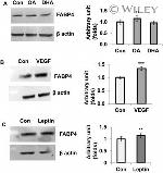 FABP4 Antibody in Western Blot (WB)