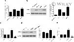 FOXC2 Antibody in Western Blot (WB)