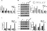 Vimentin Antibody in Western Blot (WB)