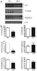 Phospho-Caveolin 2 (Tyr19) Antibody in Western Blot (WB)