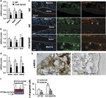 Syndecan 2 Antibody in Immunohistochemistry (IHC)