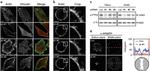 alpha Adaptin Antibody in Immunocytochemistry (ICC/IF)