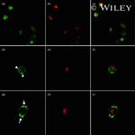 TRIM21 Antibody in Immunocytochemistry (ICC/IF)