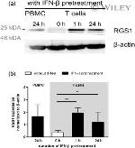 RGS1 Antibody in Western Blot (WB)