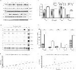 Phospho-Tau (Thr205) Antibody in Western Blot (WB)