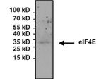 eIF4E Antibody in Immunoprecipitation (IP)