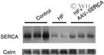 SERCA2 ATPase Antibody in Western Blot (WB)