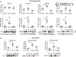 Phospho-Tau (Ser199) Antibody in Western Blot (WB)