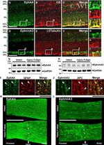 EphA4 Antibody in Western Blot (WB)