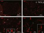 Connexin 43 Antibody in Immunohistochemistry (IHC)