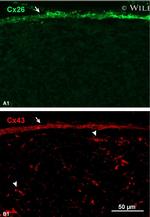 Connexin 43 Antibody in Immunohistochemistry (IHC)