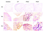 PADI2 Antibody in Immunohistochemistry (Paraffin) (IHC (P))