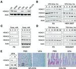 HDAC2 Antibody in Immunohistochemistry (Paraffin) (IHC (P))