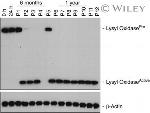 LOX Antibody in Western Blot (WB)