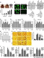 Estrogen Receptor beta Antibody in Western Blot, Immunocytochemistry (WB, ICC/IF)