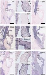 CDH11 Antibody in Immunohistochemistry (IHC)