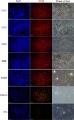 SOX9 Antibody in Immunocytochemistry (ICC/IF)