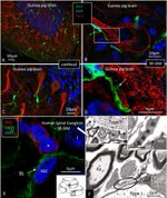 IBA1 Antibody in Immunohistochemistry (IHC)