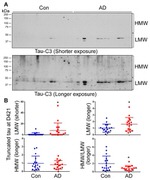 Tau (Cleaved Asp421, Asp422) Antibody in Western Blot (WB)