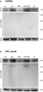 Phospho-Tau (Ser199) Antibody in Western Blot (WB)