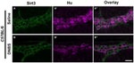 HuC/HuD Antibody in Immunohistochemistry (IHC)